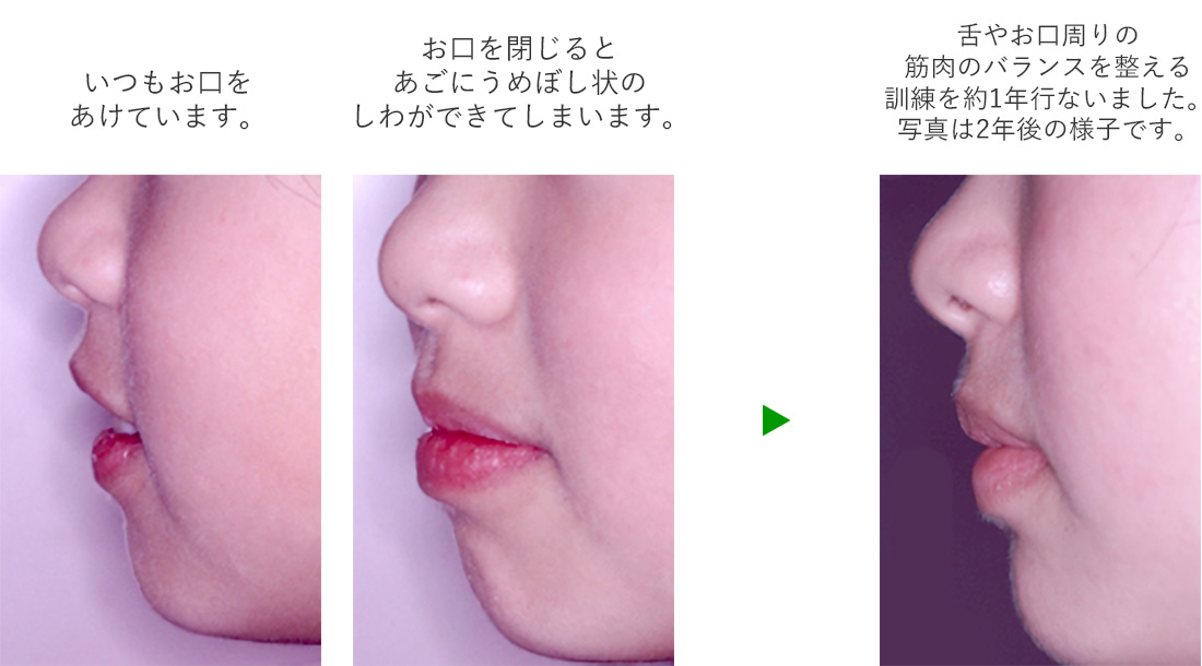 筋肉のバランスを整えます