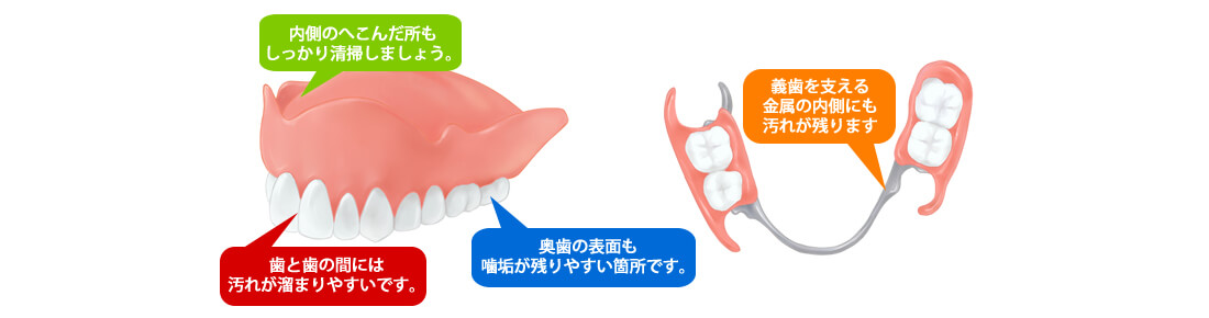 Amazon.co.jp: み 上総義歯 歯科 総義歯 サンプル 見本 入れ歯