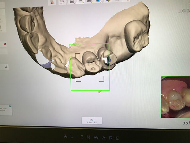 3D画像イメージ