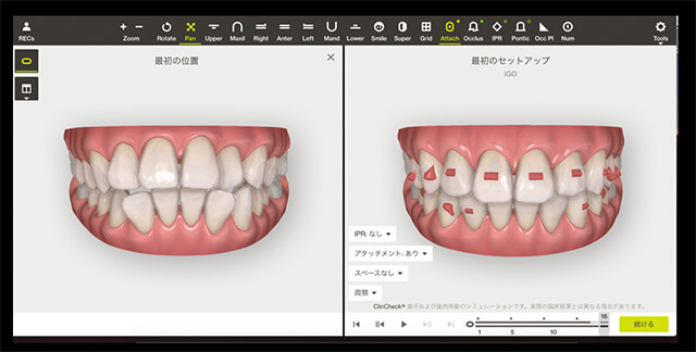 シミュレーション 正面