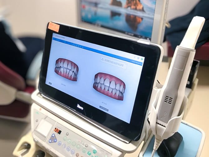 iTeroエレメント5D