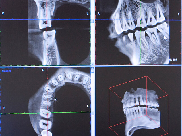 Step1 診査と治療計画