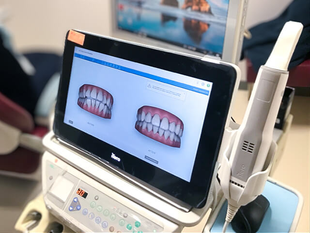 iTeroエレメント5D