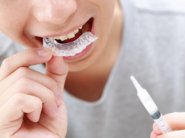 おうちで簡単!ホームホワイトニング