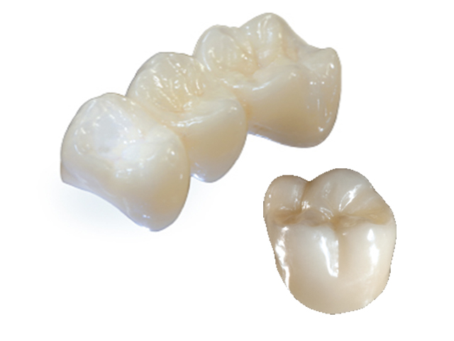 ジルコニアクラウン(かぶせもの) ジルコニア