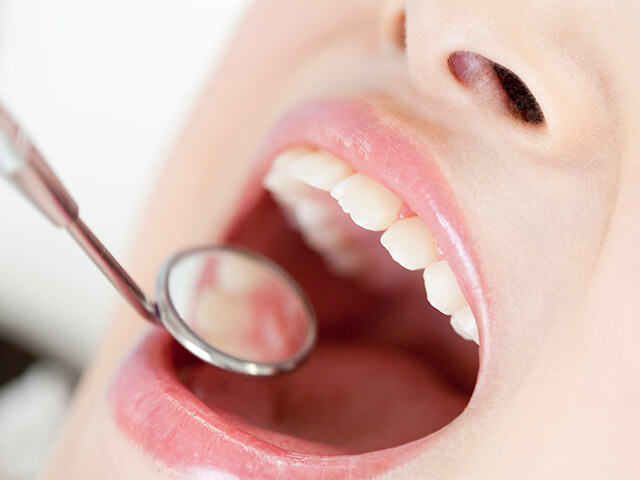 Step7 メンテナンス