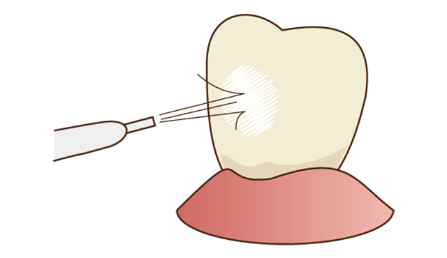 Step3 研磨剤の洗浄します。