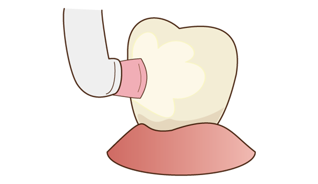 Step2 歯の表面を磨きます。