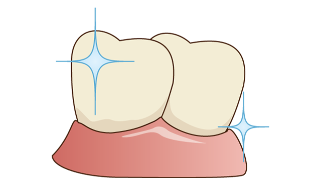 Step4 フッ素を塗布して終了です。