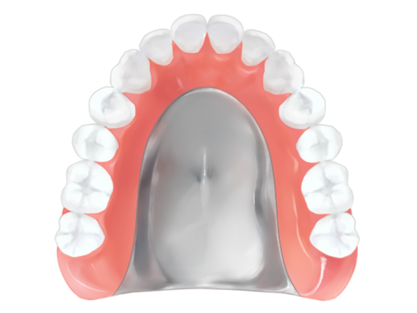 金属床義歯（総義歯）