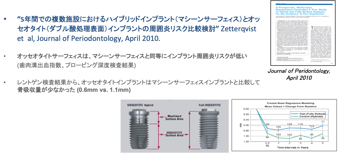 当院のインプラントシステム - 郡山でインプラントなら宝沢伊藤歯科医院