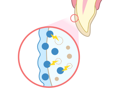 ホワイトニング剤を塗布した状態