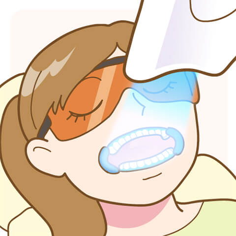 歯科医院で行うオフィスホワイトニング