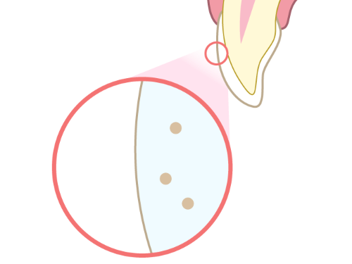 色素が減って歯が白く美しく変身なった状態