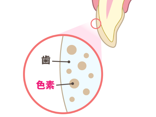 歯の色が黄色い状態