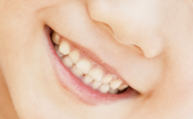 乳歯のエナメル質や象牙質