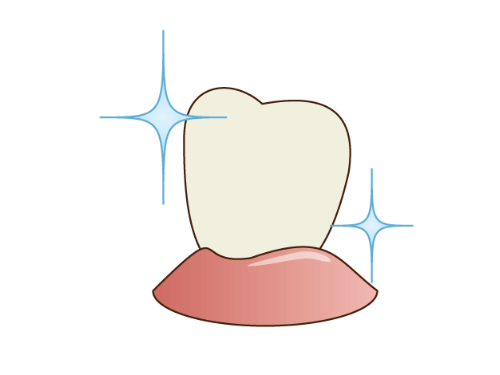 4.フッ素を塗布