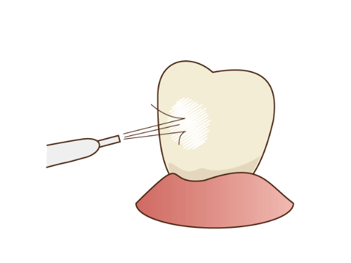 3.お口の中を洗浄