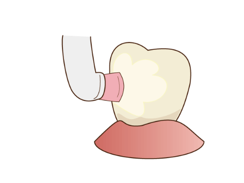 2.クリーニングペーストを塗り研磨