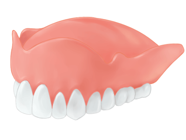 総入れ歯 (総義歯)