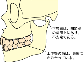 上下の歯が安定して噛み合ったときに、下顎頭が下顎窩の斜面上にあり不安定の状態