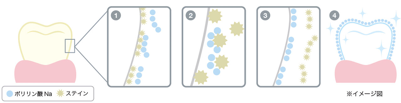 ポリリン3Dホワイトニングシステムとは
