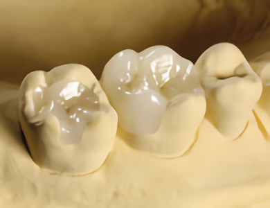 Step4口腔内セット