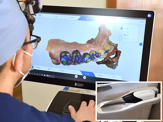 セレックシステム