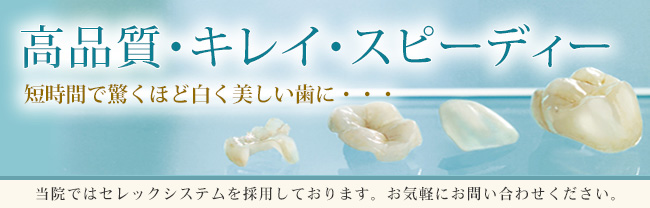 セレックの特徴