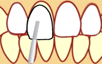 STEP4