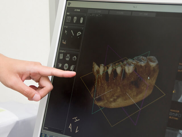 STEP1 調査・術前計画