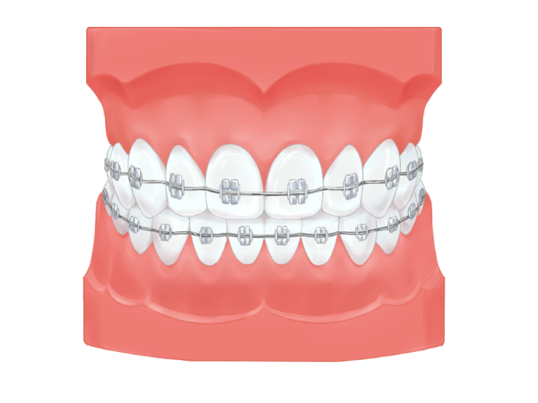 矯正治療について 仙台市若林区の歯医者 太紀デンタルクリニック