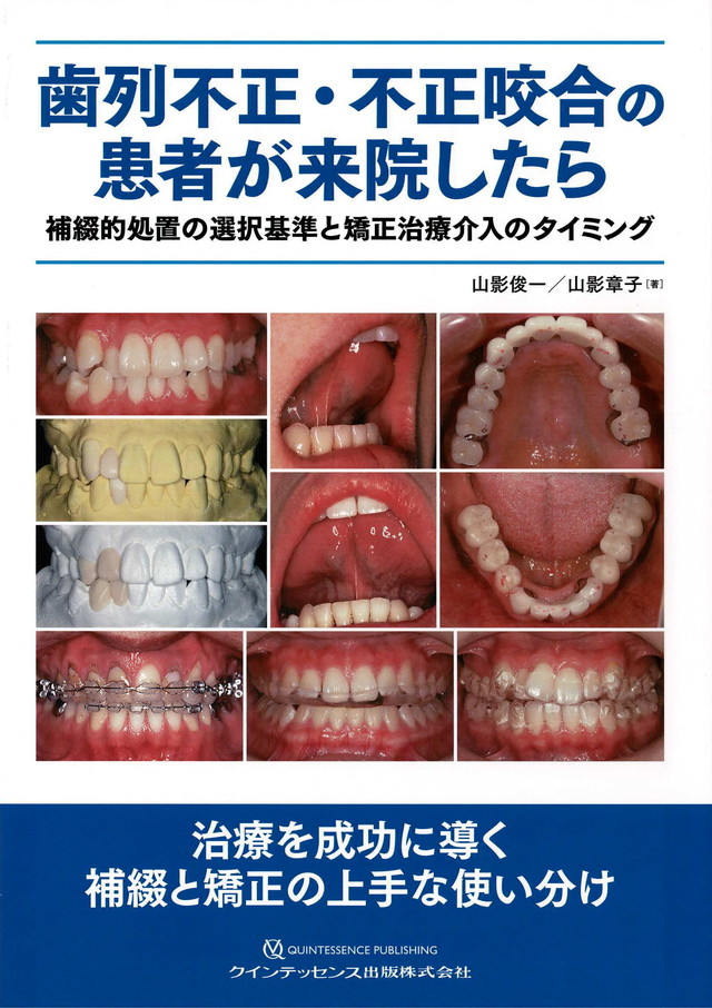 歯列不正・不正咬合の患者が来院したら」クインテッセンス社出版