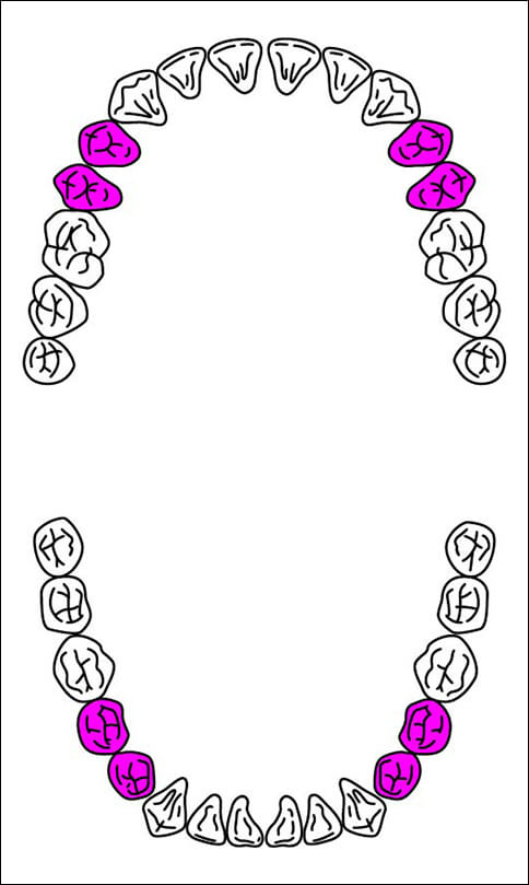 白い歯が保険適用になったのはご存知ですか?