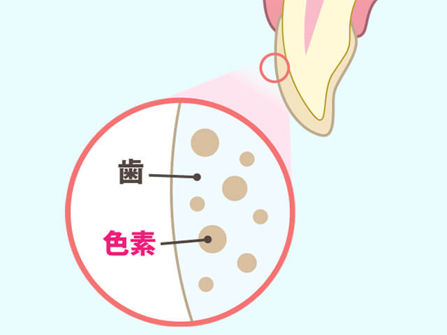 ホワイトニングのメカニズム ①