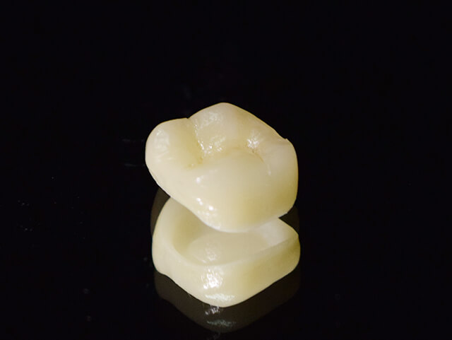 セラミッククラウン