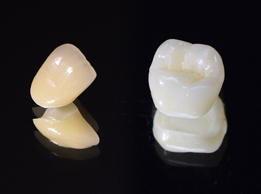 セラミック治療