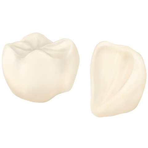 ハイブリットセラミック