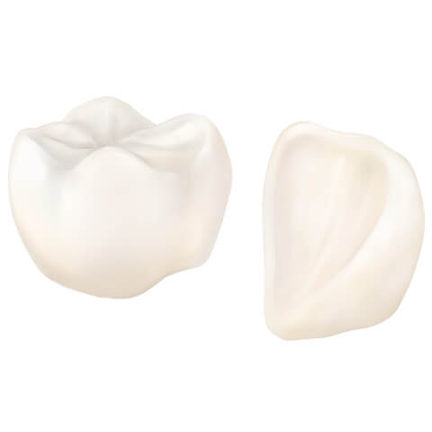 オールセラミック