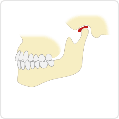 正常な関節円板とあごの動き