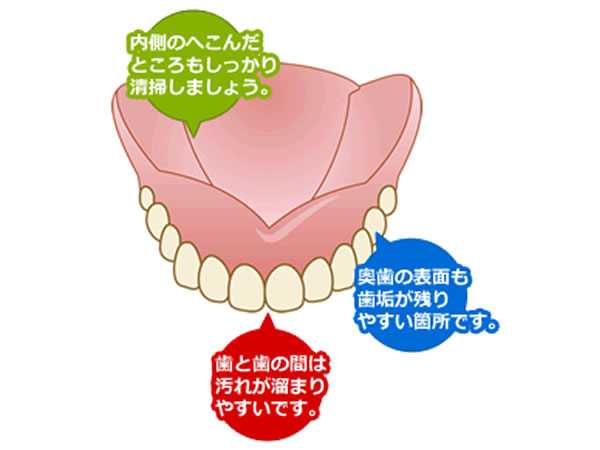 義歯（入れ歯）の清掃について