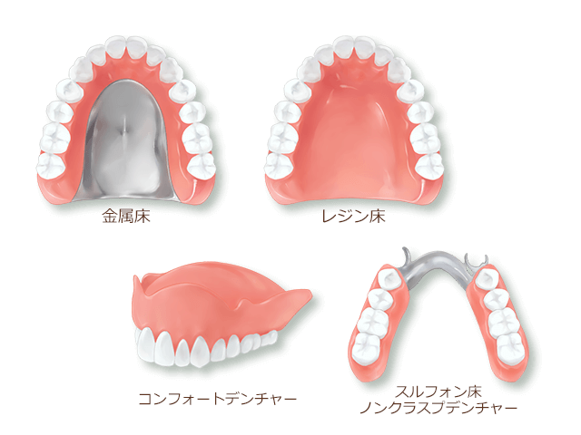 入れ歯の種類について