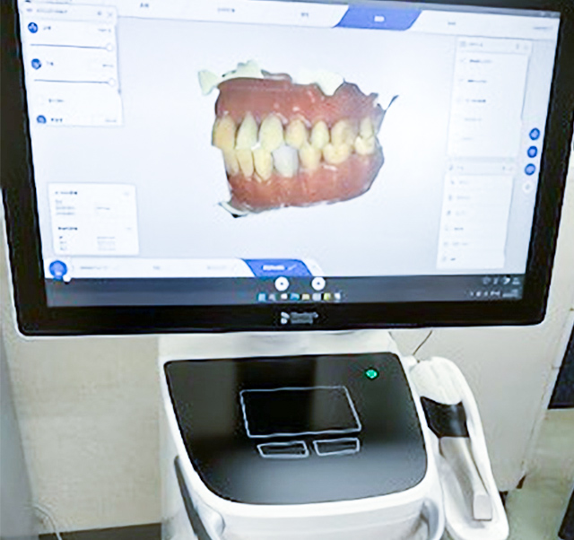 高精度の歯科用3Dスキャナー【CAD】