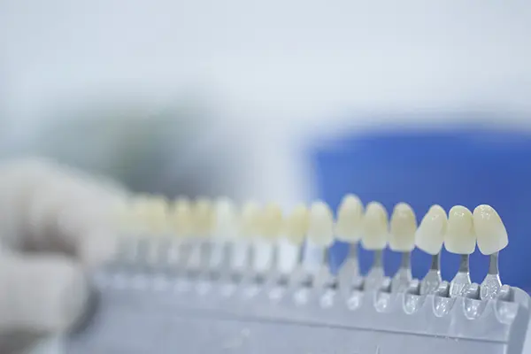 審美歯科治療