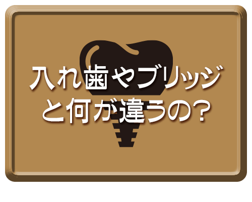 インプラントってどんな治療？