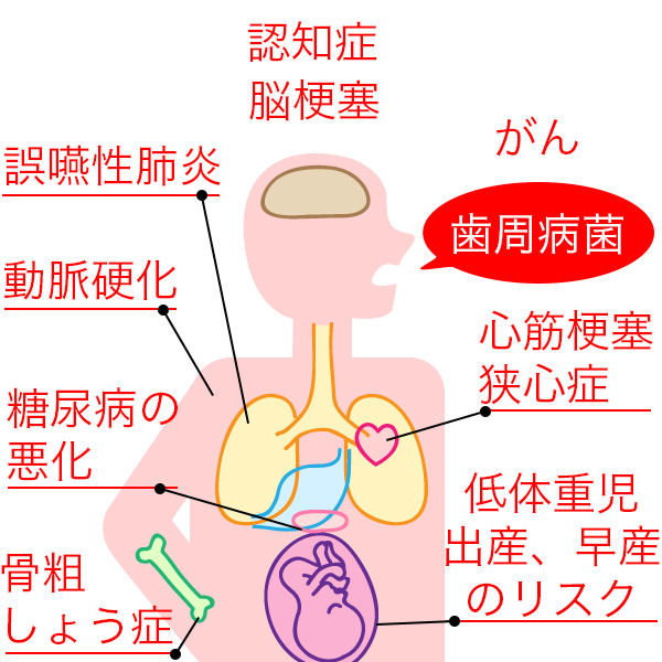 歯周病と全身疾患の関係