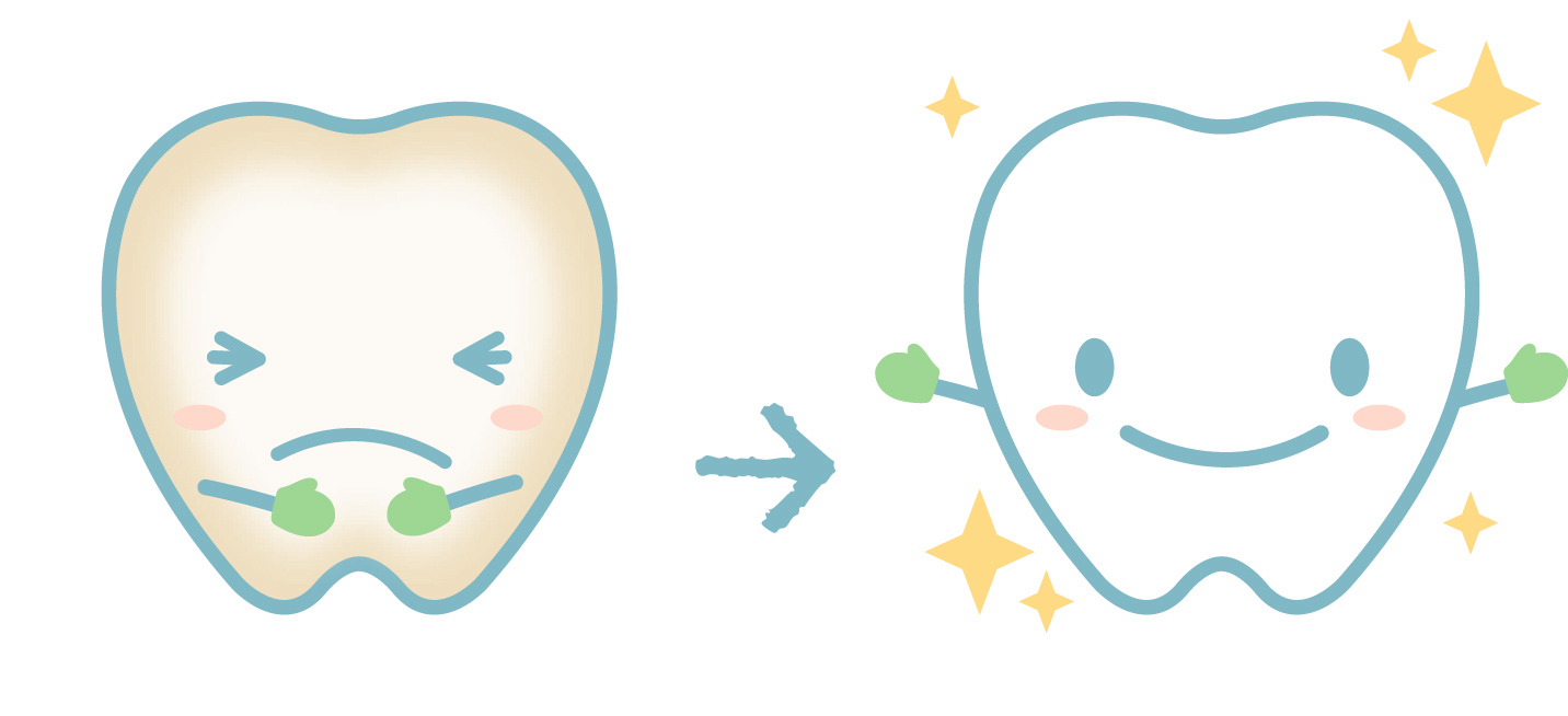 歯の着色 普段気をつける事とは 歯合わせブログ 仙台市青葉区南吉成の歯科医院 まさみ歯科