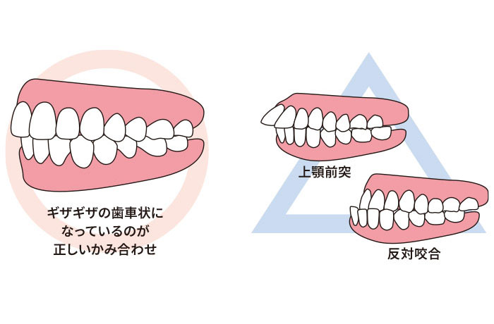 噛み合わせとは