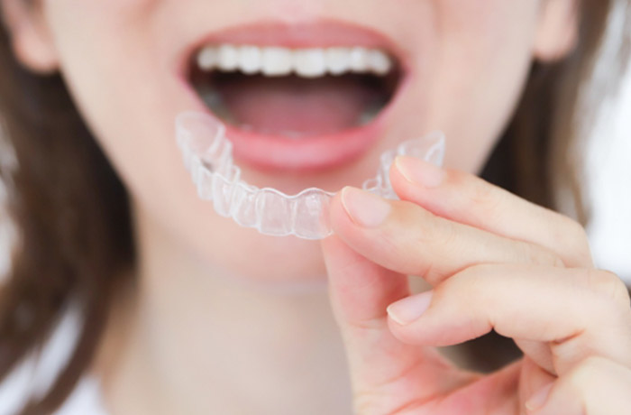 マウスピース矯正