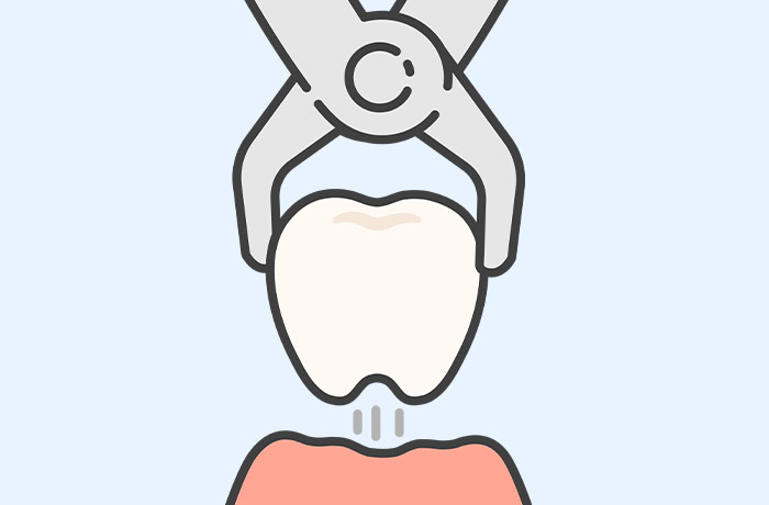 矯正治療では必ず抜歯しなくてはいけないの？